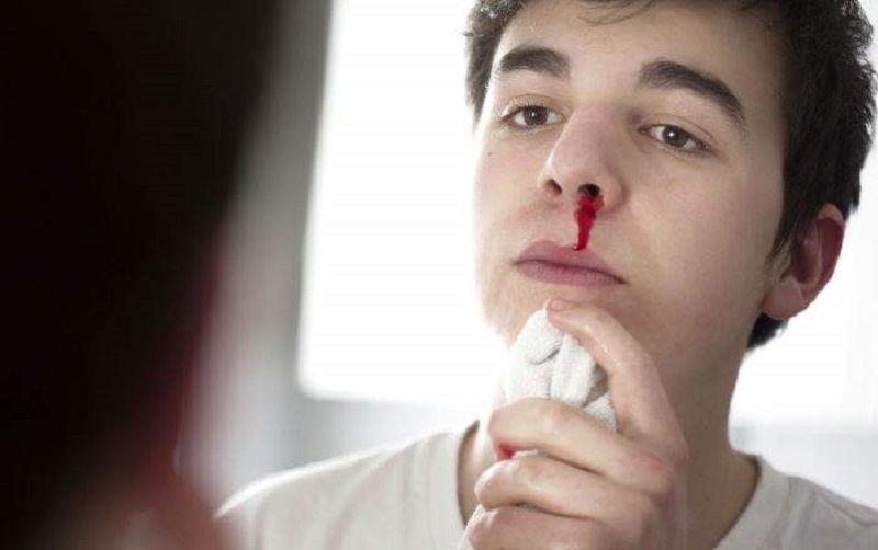 nam-mo-chay-mau-mui-danh-con-gi Mơ chảy máu mũi đánh con gì đẹp