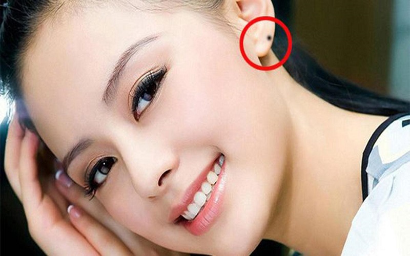 Nốt ruồi phú quý may mắn - Nốt ruồi có quý nhân phù trợ 2 Nốt ruồi mang lại may mắn nằm ở tai