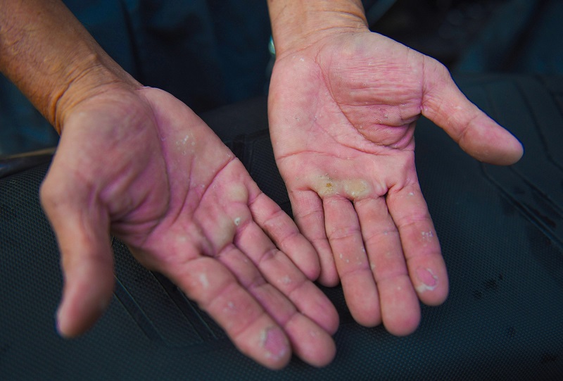 Bàn tay phú quý - Dấu hiệu phú quý trong lòng bàn tay 3 Tướng bàn tay phú quý có đặc điểm gì khác biệt so vời người khác?