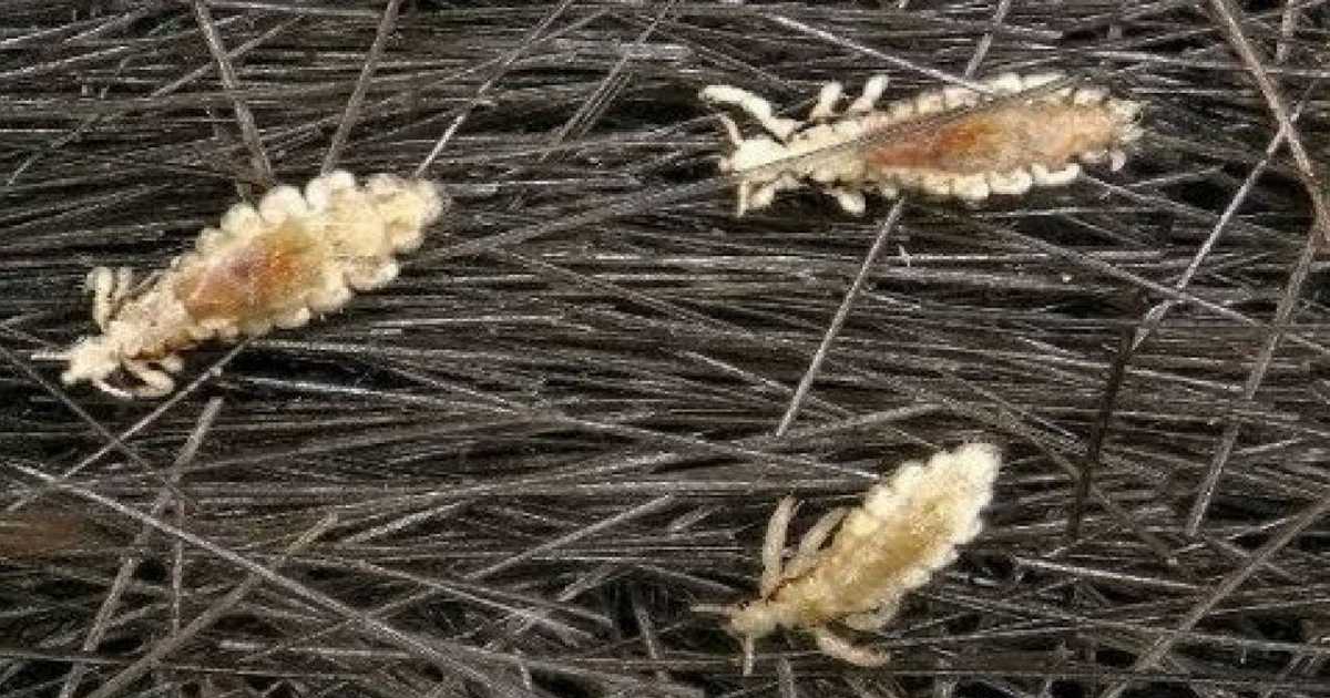 mo-thay-con-chay-04 Mơ thấy con chấy ở nhiều nơi