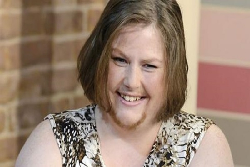 Nằm mơ thấy mọc râu là số mấy? Giải mã giấc mơ mọc râu 2 mo-thay-nguoi-khac-moc-rau