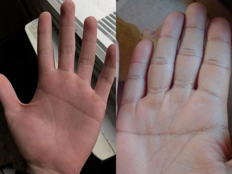 Đường chỉ tay chữ nhất