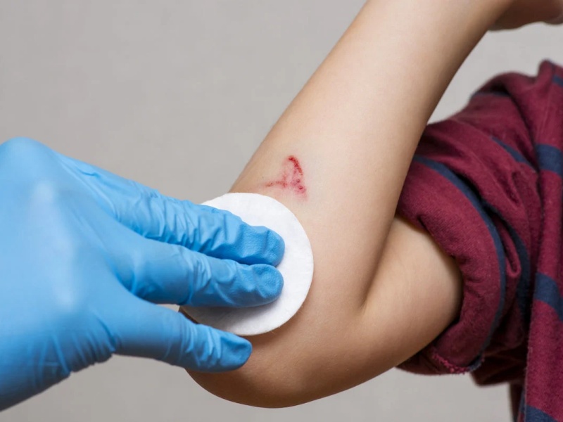 Ngủ mơ thấy máu: Ý nghĩa điềm báo và con số may mắn 1 Ngủ mơ thấy máu đã lành