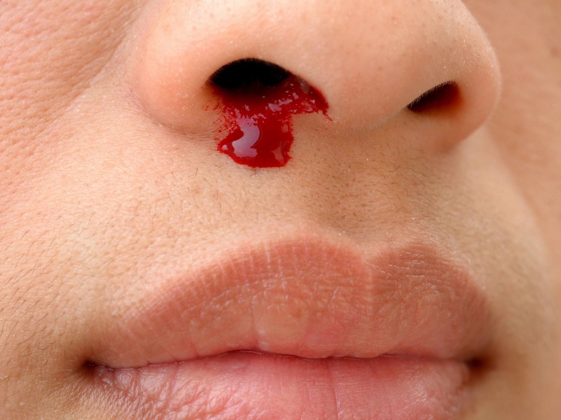 Ngủ mơ thấy máu: Ý nghĩa điềm báo và con số may mắn 2 Ngủ mơ thấy máu từ vết thương cơ thể